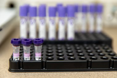 Gomel, Belarus-18 Ekim 2020: Vacusera kan toplama sistemleri. Laboratuvar testleri için venöz kan tüpleri..