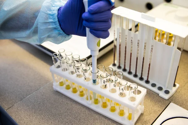 Badanie Surowicy Krwi Probówkach Laboratorium Badania Biochemicznej Identyfikacji Bakterii Probówkach — Zdjęcie stockowe
