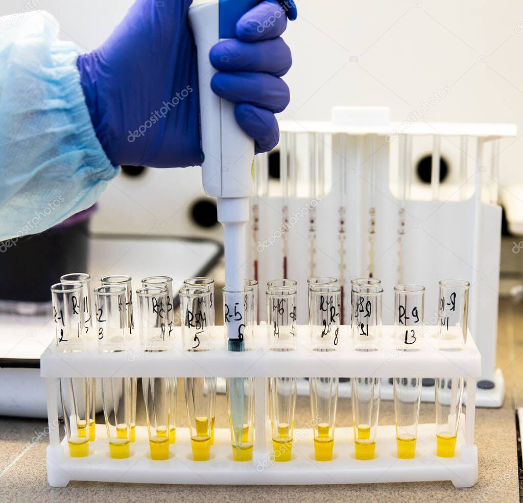 Study of blood serum in test tubes in the laboratory. Tests for the biochemical identification of bacteria in test tubes. Medical laboratory equipment.