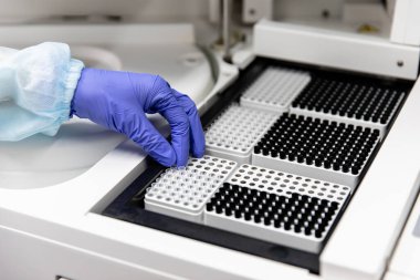 Bir kadın tıbbi malzemeler üzerinde analiz yapar. Covid-19 virüsüne karşı yeni bir aşı geliştirildi. Tıbbi laboratuvar. Laboratuar tıbbının kalite kontrolü.