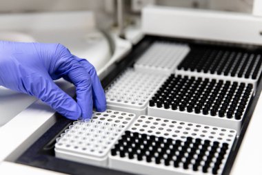 Bir kadın tıbbi malzemeler üzerinde analiz yapar. Covid-19 virüsüne karşı yeni bir aşı geliştirildi. Tıbbi laboratuvar. Laboratuar tıbbının kalite kontrolü.