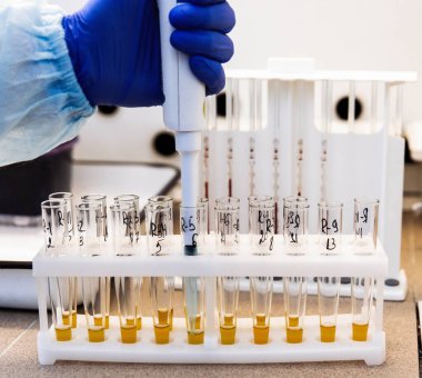 Laboratuvardaki test tüplerinde kan serumunu incele. Test tüplerindeki bakterilerin biyokimyasal tanımlaması için yapılan testler. Tıbbi laboratuvar ekipmanları.