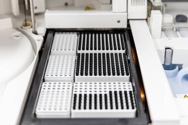 Bağışıklık sistemi analizinde kan analizi. Tıbbi laboratuvar. Laboratuvar tıbbının kalite kontrolü. İmmünokimyasal analiz cihazının çalışması.