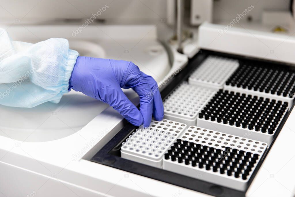 A woman makes an analysis on medical equipment. Development of a new vaccine against the covid-19 virus. Medical laboratory. Quality control of laboratory medicine.