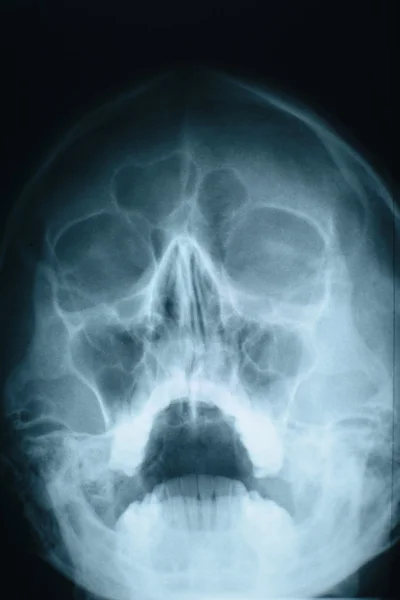 Radiographie de tête — Photo