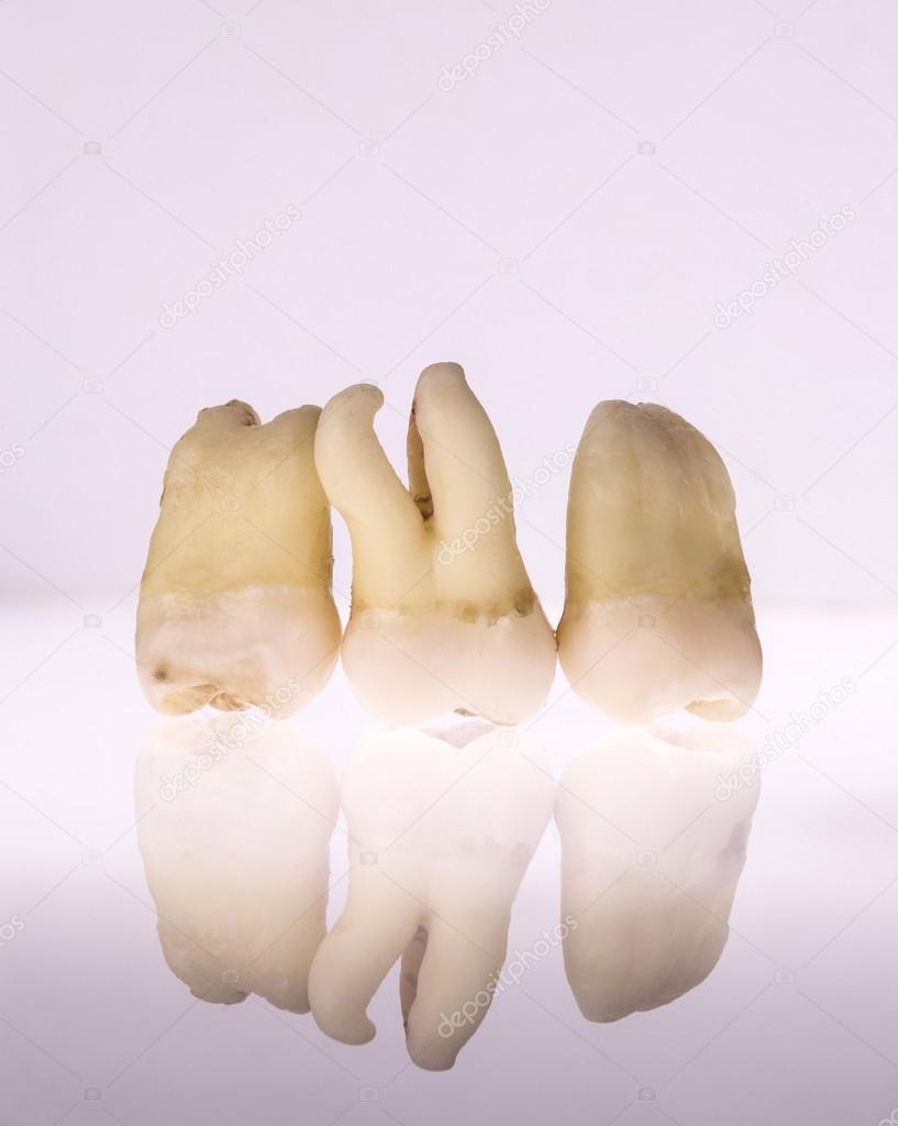 Group of extracted teeth