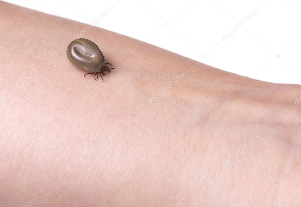 Tick on a skin