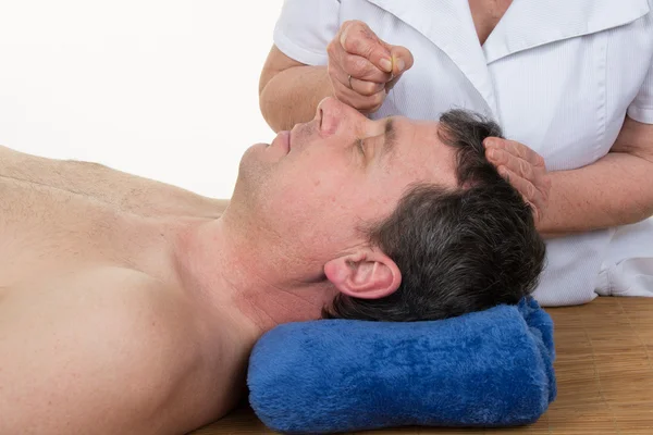 Primer plano de un hombre recibiendo tratamiento de acupuntura — Foto de Stock