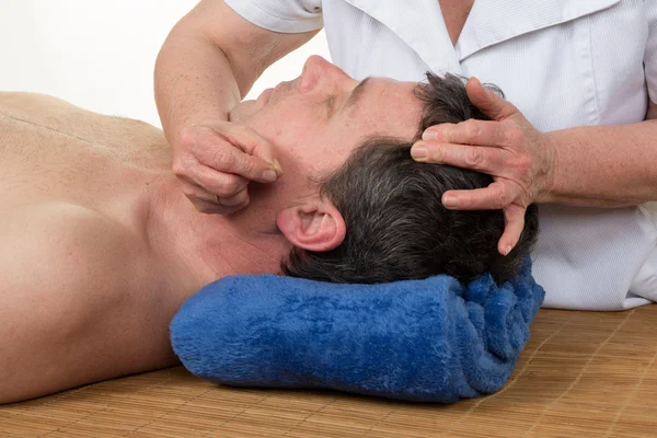 Closeup of hand performing acupuncture therapy on customer's back at salon — Stock Photo, Image