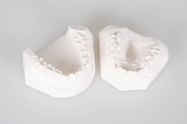 Модель гипсокартонных зубов на белом фоне