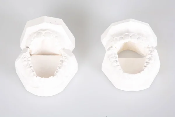 Zahnimplantate Gipsabdruck Weiße Gipszähne Dentallabor Auf Grauem Hintergrund — Stockfoto