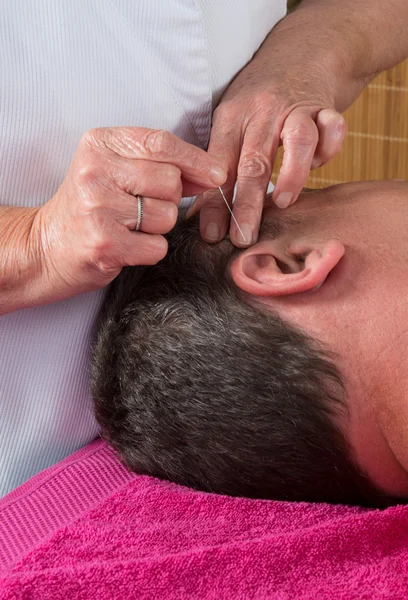 Acupuncteur se prépare à taper aiguille sur l'oreille de l'homme — Photo