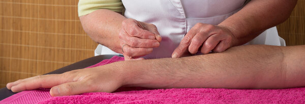 Acupuncturist готовится к открытию иглы
