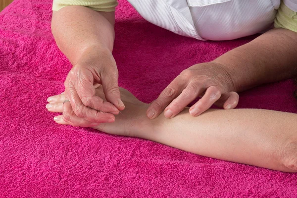 Detalhe do acupunturista colocando uma agulha na mão do paciente — Fotografia de Stock