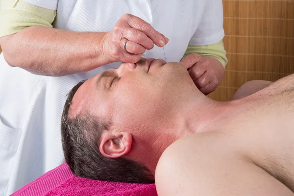 Akupunkteur bereitet sich darauf vor, Nadel im Gesicht des Mannes anzuzapfen — Stockfoto