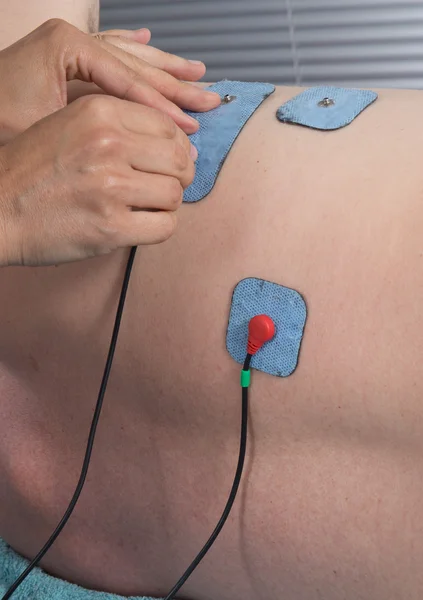 Man with electrostimulator electrodes — Stock Photo, Image