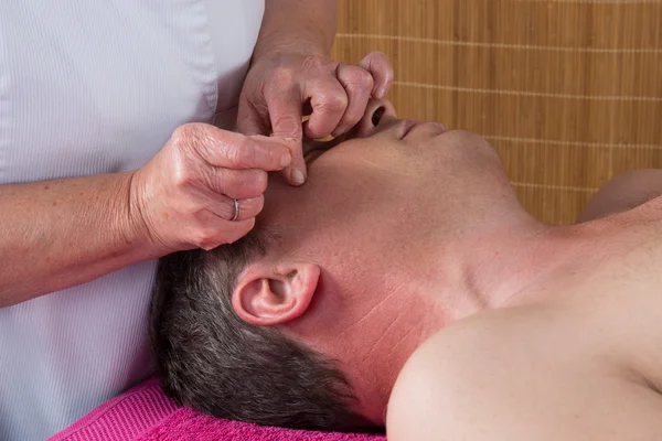 Adamın yüzünü çevresinde iğne girmeleri akupunktur uzmanı hazırlar — Stok fotoğraf