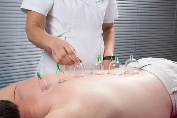 Cupping Terapia — Foto Stock