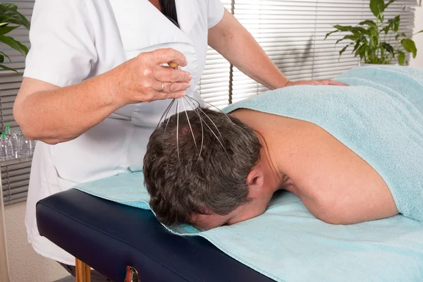 Alternativní masáže, muž s čínskou terapii vyléčit — Stock fotografie