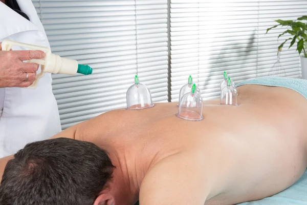 Альтернативный массаж, мужчина, получающий китайскую терапию для лечения — стоковое фото