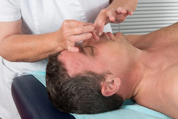 Man in an acupuncture therapy at the health spa