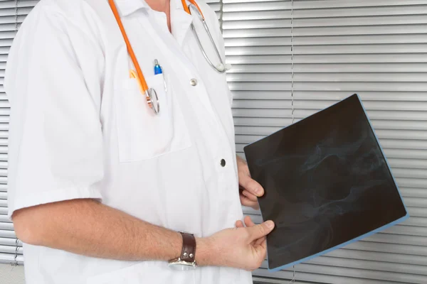 Primer plano del médico masculino que sostiene la radiografía en hosptital — Foto de Stock