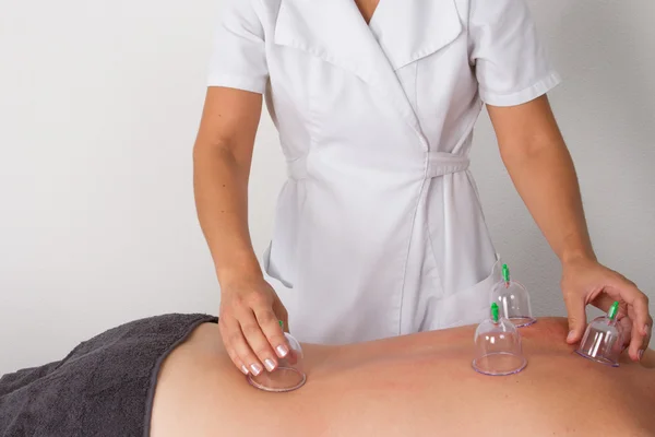 Young attractive woman receiving cupping acupuncture treatment — Stock Photo, Image