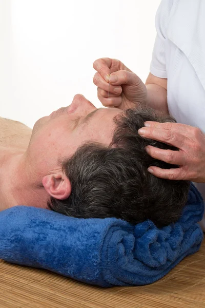 Hombre en terapia de acupuntura en el spa de salud — Foto de Stock