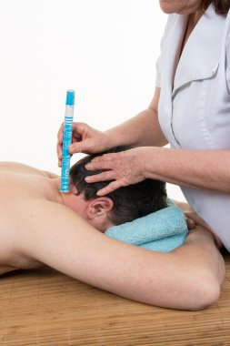 Acupuncture therapist using moxibustion on the back of patient clipart