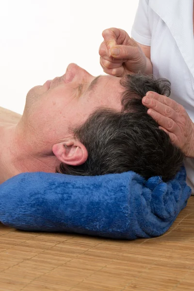 Primer plano de una aguja de acupuntura de mano en la espalda masculina — Foto de Stock