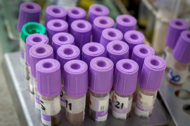 Laboratuvar rafına yerleştirilmiş mor kaplamalı kan toplama tüplerinin yakın çekimleri klinik analiz için hazır.