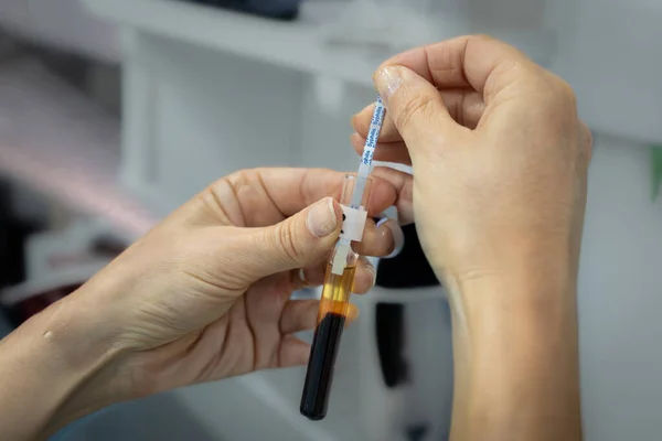 Eller dikkatlice ayrıştırılmış serum ve plazma içeren kan örneği tüpüne etiket koyar..