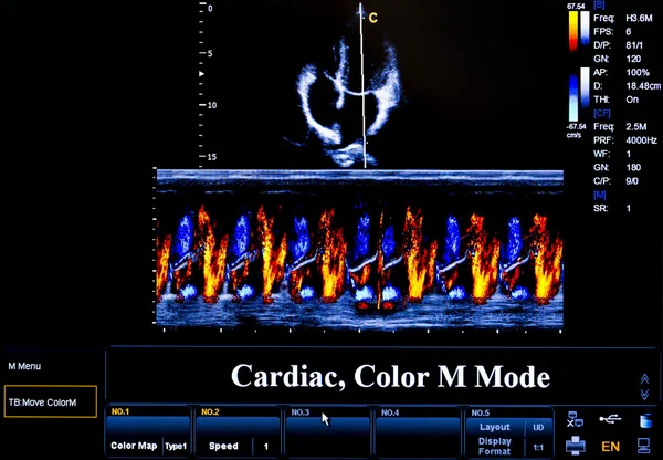 Imagem de monitor de ultra-som colorido. Cardíaca — Fotografia de Stock