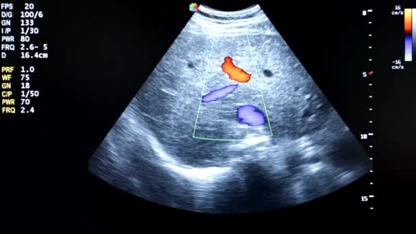 Kleurrijke echografie monitor beeld. Cardiale pulse — Stockvideo