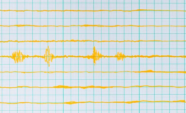Seismologische apparaat blad - Seismometer — Stockfoto