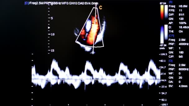 Imagen colorida del monitor de ultrasonido. Cuatro cámaras con vista al corazón del bebé — Vídeos de Stock