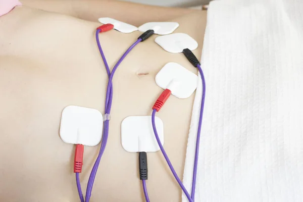 Physical therapy of the abdomen with the help of electrode pads, percutaneous electrical stimulation of the nerves. moistimulation, electrical stimulation, physiostimulation, myolifting. Belly Weight Loss