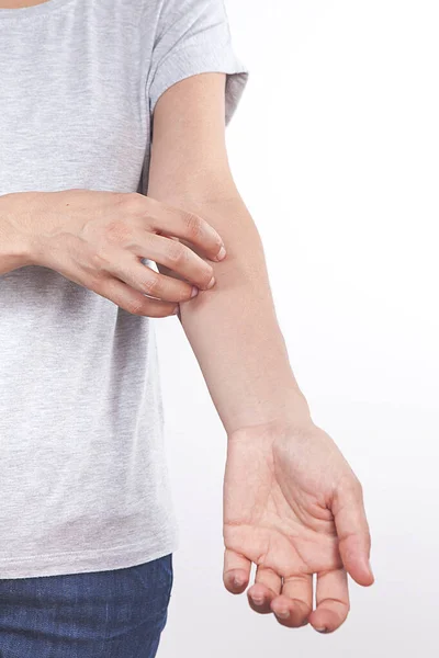 Vrouw Krabt Aan Haar Arm — Stockfoto