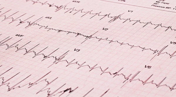 Cardiogram pulse monitoring. Health concept.