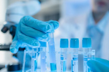 Bilimsel ekipman ve test tüpleriyle çevrili bir laboratuvarda kimya araştırmacısı, yenilikleri, bilimsel gelişimi ve modern tıbbi araştırma ortamını temsil ediyor..