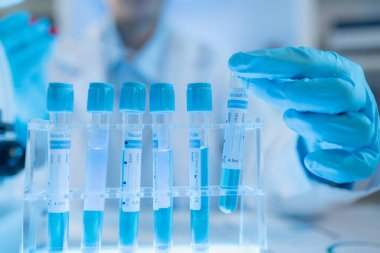 Bilimsel ekipman ve test tüpleriyle çevrili bir laboratuvarda kimya araştırmacısı, yenilikleri, bilimsel gelişimi ve modern tıbbi araştırma ortamını temsil ediyor..