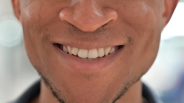 Close up de boca de homem africano casual sorrindo — Fotografia de Stock