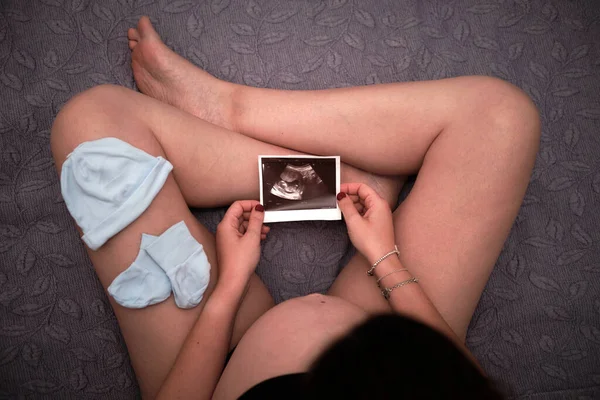 Zwangere vrouw kijkt naar een echo scan van haar baby — Stockfoto