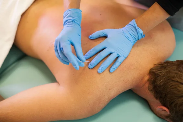 의사가 침술에 사람의 바늘을 로열티 프리 스톡 이미지