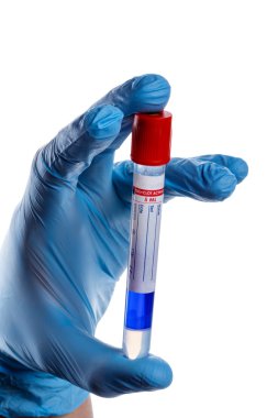 el ile bir test tüpü