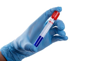 el ile bir test tüpü