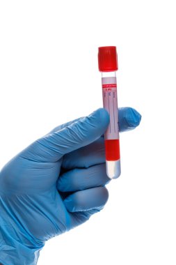 el ile bir test tüpü