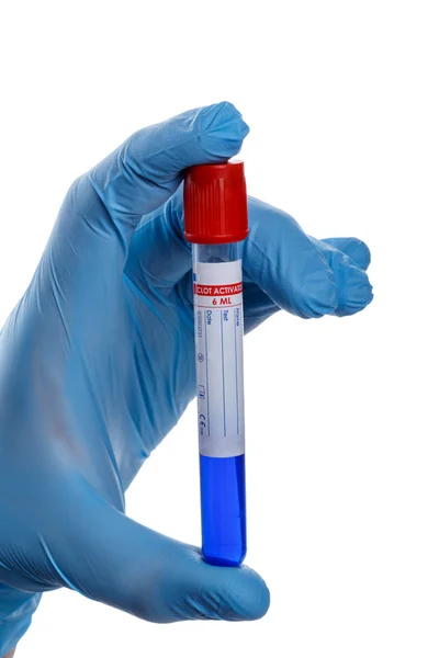 Hand with a test tube — Stock Photo, Image