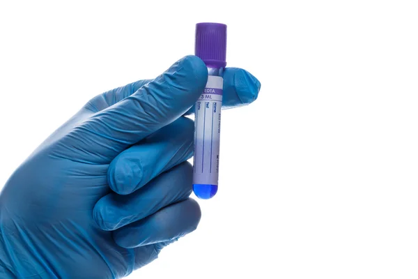 Hand with a test tube — Stock Photo, Image