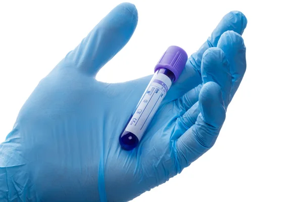 Hand with a test tube — Stock Photo, Image